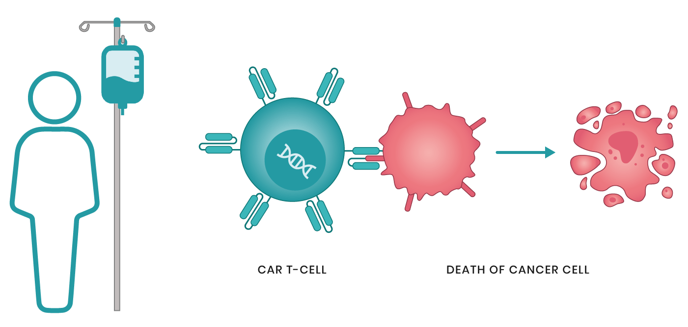 CAR T-Cell Therapy: The Past, Present, and Future of Cancer Immunotherapy